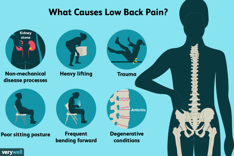 back pain causes