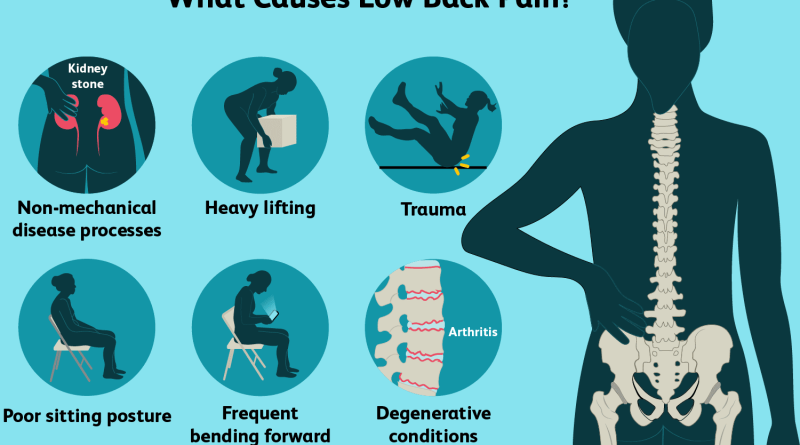 back pain causes